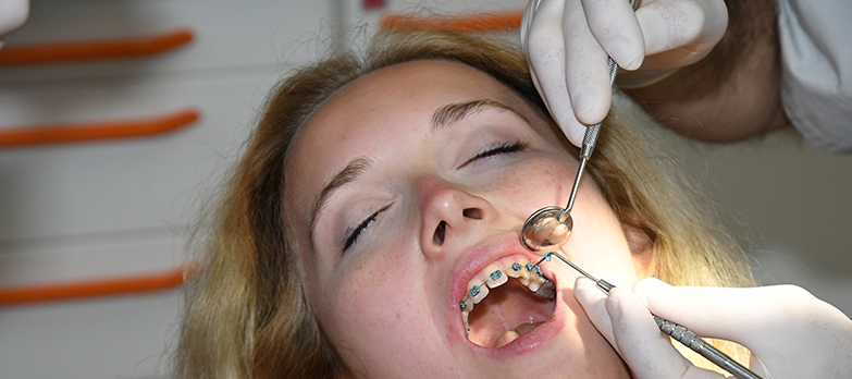 Ortodonzia fissa