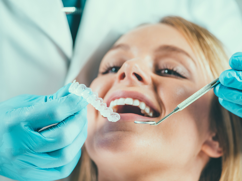 Teeth,Whitening,Procedure
